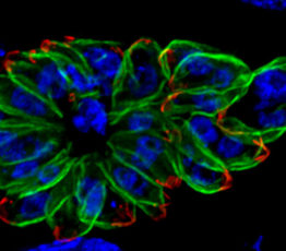 #ScienceDurable – Dans le laboratoire du MNHN, les vers parasites source d’étude et d’inspiration médicale